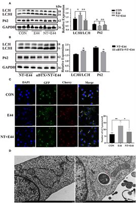 Nicotine Reduces Human Brain Microvascular Endothelial Cell Response to Escherichia coli K1 Infection by Inhibiting Autophagy